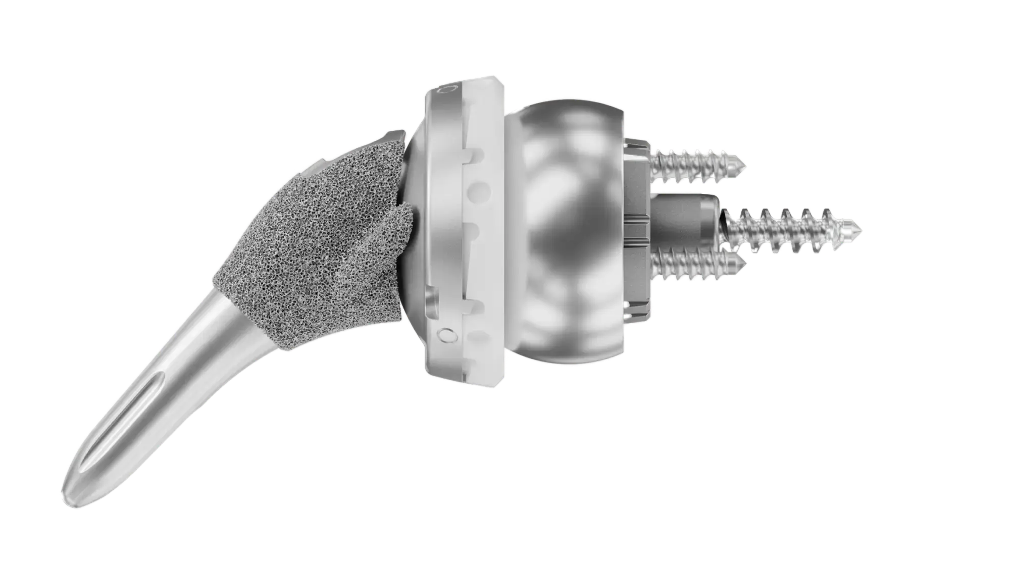 InSet® Reverse Shoulder System implant